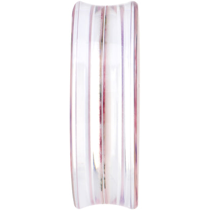 40mm Acrylic Pink Grandma's Wallpaper Flowered Saddle Plug